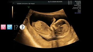 14+2 weeks fetus. Detailed view of organs, brain, spine, extremities. Gender revealed. Boy or girl?