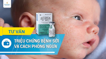 Triệu chứng bệnh sởi và tiêm vacxin sởi phòng ngừa bệnh