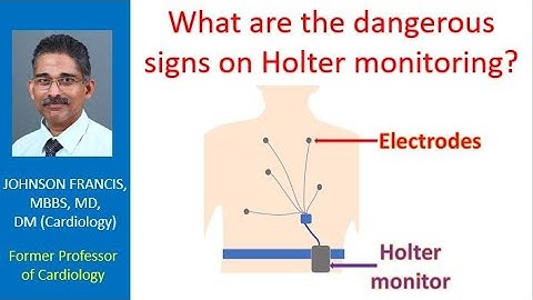 What are the dangerous signs on Holter monitoring?