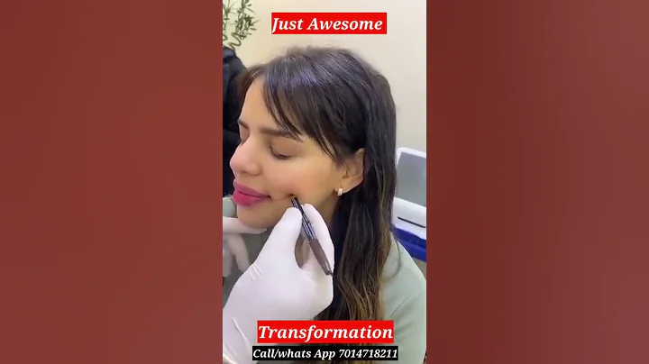 Amazing Dimple Creation Treatment #shorts