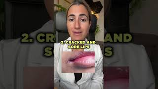 10 Signs Of Vitamin B6 Deficiency #shorts 10 Signs Of Vitamin B6 Deficiency #shorts