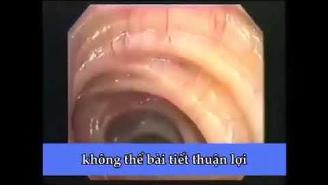 Video nội soi đường ruột của tiến sĩ người Nhật