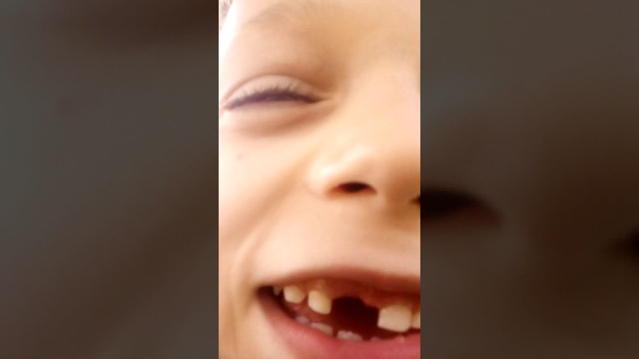 5 кесарей спор