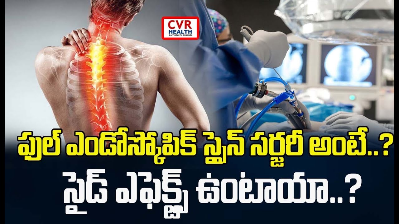 ఫుల్ ఎండోస్కోపిక్ స్పైన్ సర్జరీ అంటే..? సైడ్ ఎఫెక్ట్స్ ఉంటాయా..? | CVR Health Channel