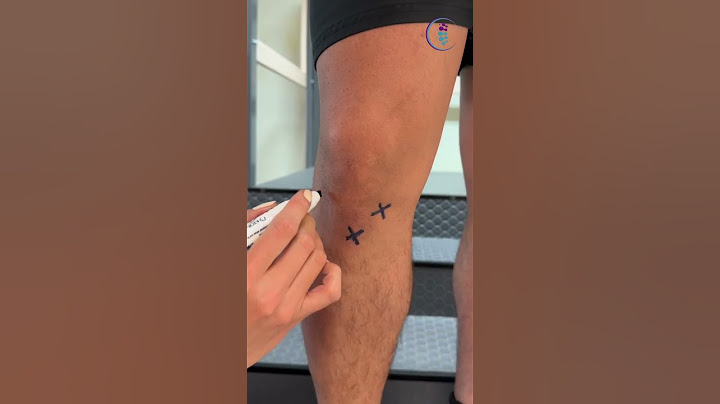 ¿Lesión en la rodilla? Identifica cuál puede ser tu lesión. #dolor #rodilla