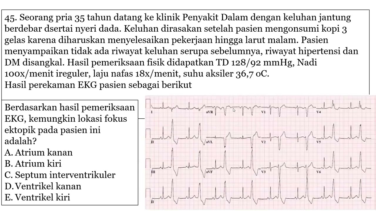 20240526 Mas Nuklir Bahas Soal
