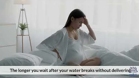 Your Water Broke—Here’s the Timeline