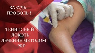 💉Латеральный Эпикондилит|Забудь про БОЛЬ в локте |Как лечить суставы PRP! screenshot 4