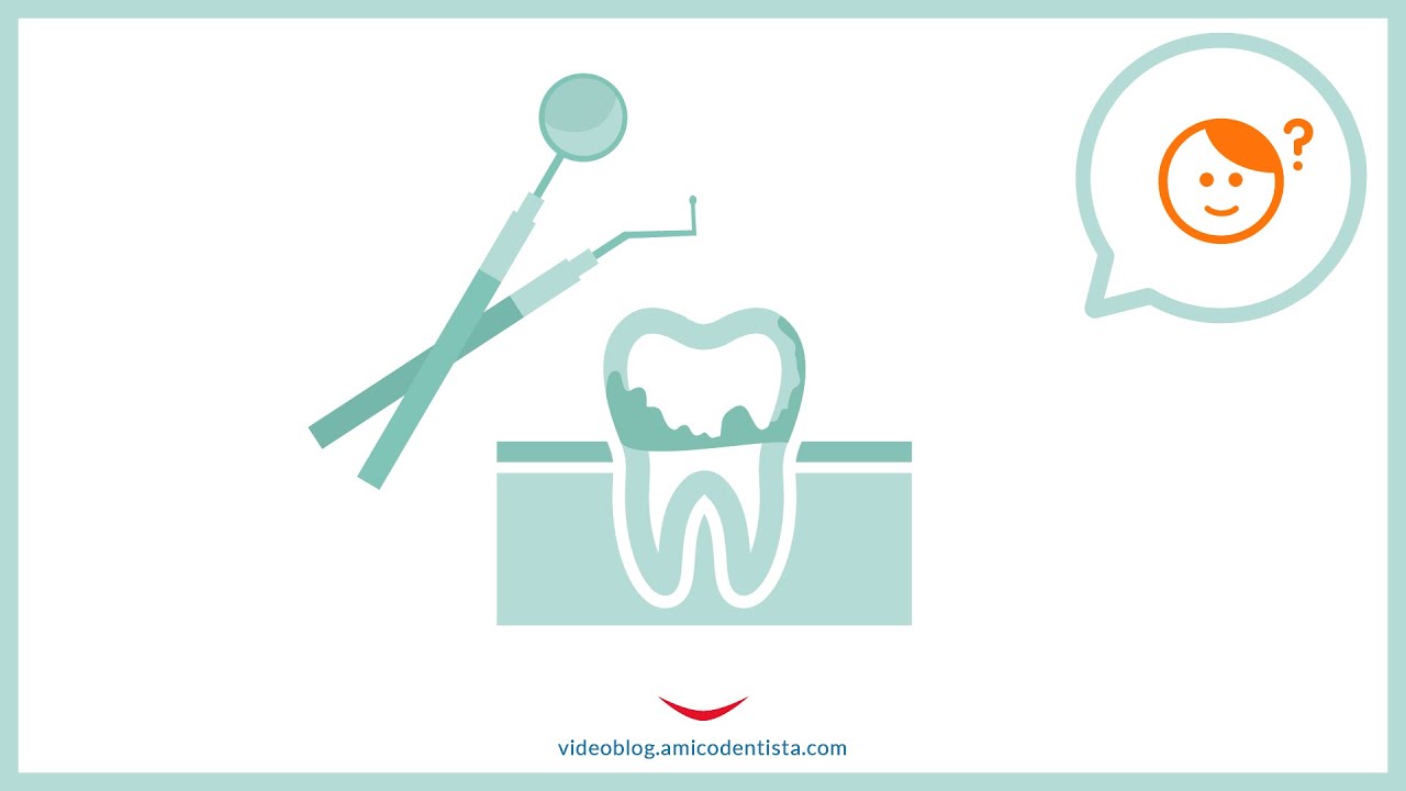 Pulizia dentale e allergie: ci sono dei rischi?