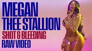 MEGAN THEE STALLION bleeding after being shot while with TOREY LANEZ  & friends