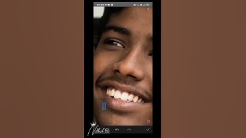 how to remove pimples in snapseed/#MR.Nithish✨editing