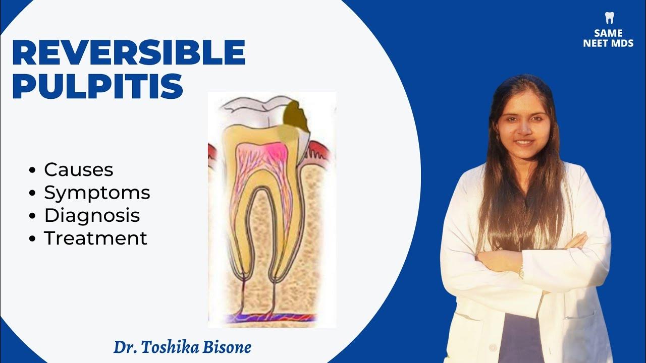 Reversible pulpitis Causes , symptoms, diagnosis, treatment YouTube