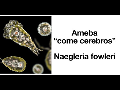 Video: Cómo evitar una infección por Naegleria Fowleri: 11 pasos