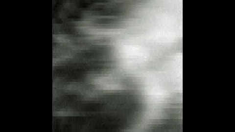 High-speed AFM imaging of human chromosomes in water