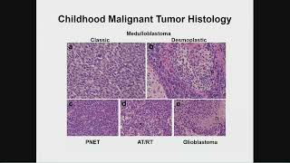 Precision Medicine Strategies for Medulloblastoma Therapy