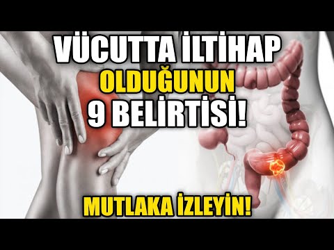 Vücutta İltihap Olduğunun 9 Belirtisi! İltihap Kurutucu Yöntemler!