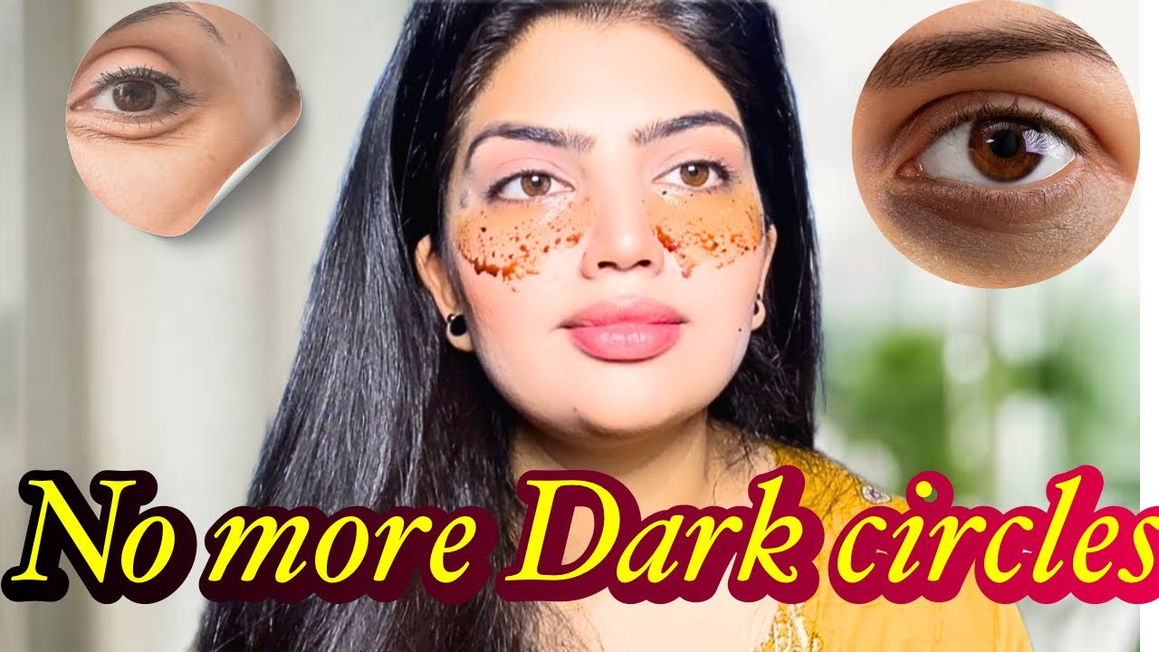 How to Remove Dark Circles, Eye Bags & Wrinkles Fast | 100% Effective Home Remedy