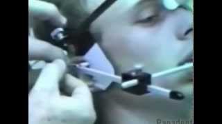 Axi-Path II Recorder Procedures