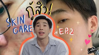 กู้สิวให้หายทำยังไง ? EP.2 l Extern Bahboh