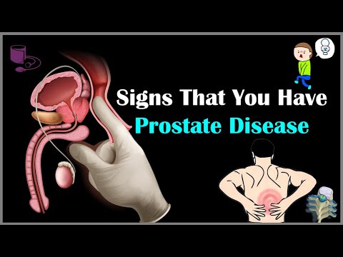 Video: Causes of prostate diseases