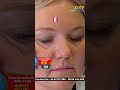 4 Step Dental Consultation For Free || Oxy Dental || Best Dental Hospital in Hyderabad