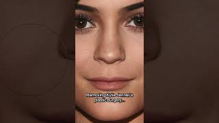 Removing KYLIE JENNERS Plastic Surgery (short)