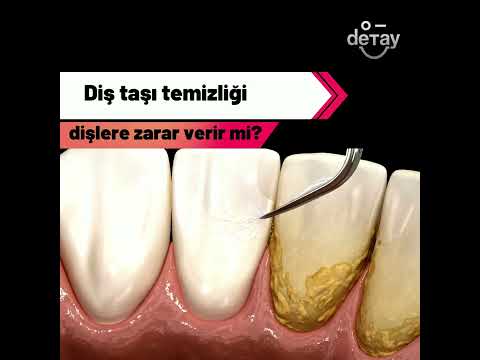 Video: Membranlararası boşluq kristaldirmi?