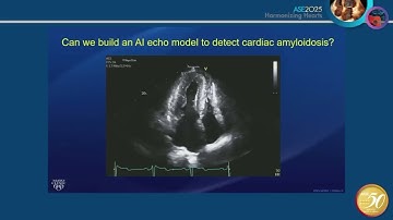 ASE 2025: Real World AI for HFpEF & Amyloidosis Unlocking Diagnostic Power from a Single Echo View
