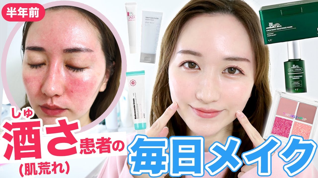 酒さでも化粧したい お気に入り韓国スキンケア コスメで毎日メイク 肌荒れ 大人ニキビ Youtube