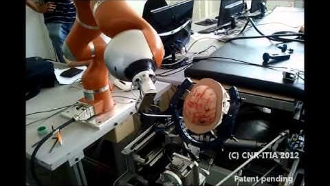 Motion compensation of the Active Headframe