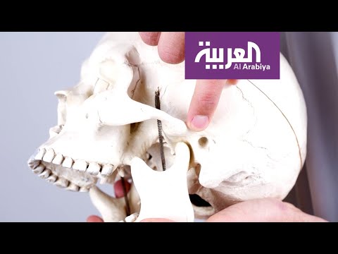 صباح العربية | كيف تتخلص من آلام مفصل الفك؟