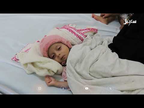الإسهال عند الأطفال: الأسباب، الأعراض، والوقاية