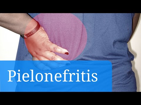 Vídeo: Pielonefritis Crónica: Tratamiento, Síntomas, Prevención