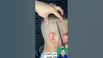 ازالة الشامة بدون دم ولا آلم 