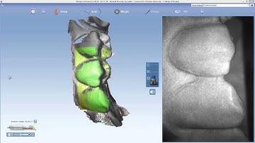 E4D Video 5 Opposing scan