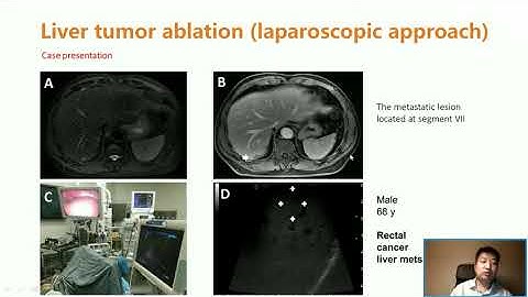 CCMA Webinar Lecture by Dr. Zhe Tang