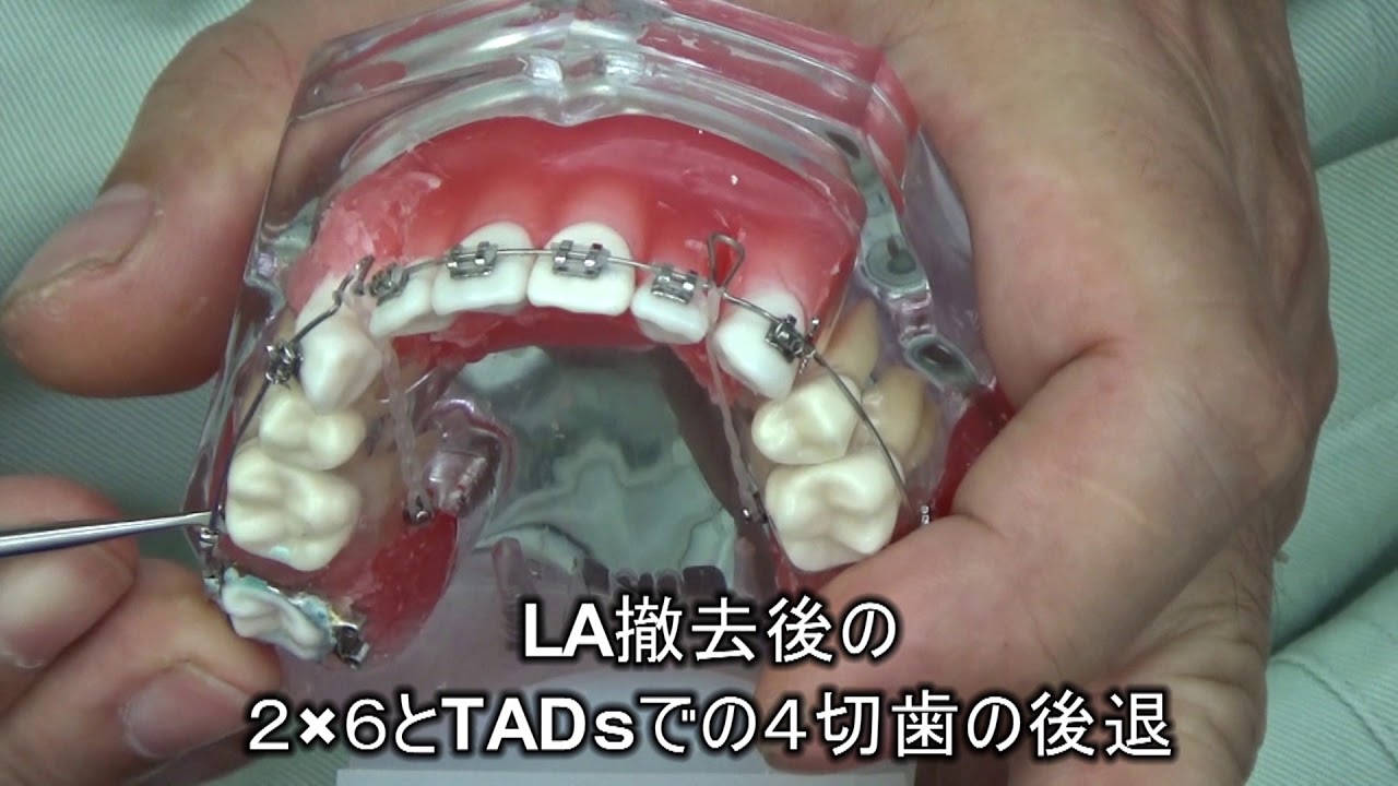 本格アドバンス編【本格アドバンスコースDVD】 << 各種タイポドント