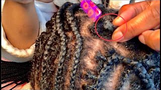 Finger and Comb Crown Scratching Between Braids | ASMR
