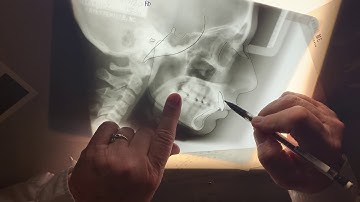 Tracing ceph video 1