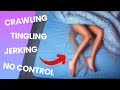 The truth about restless leg syndrome  causes symptoms  treatment