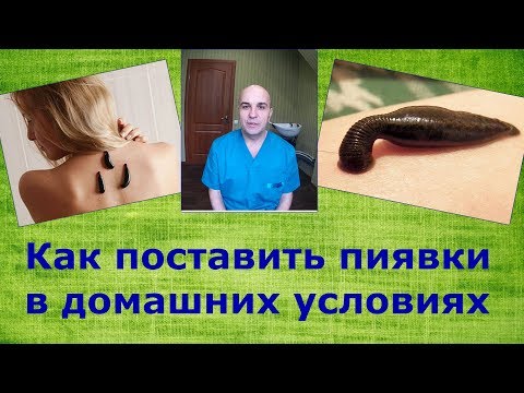 Гирудотерапия для чайников 1# Как поставить пиявки в домашних условиях