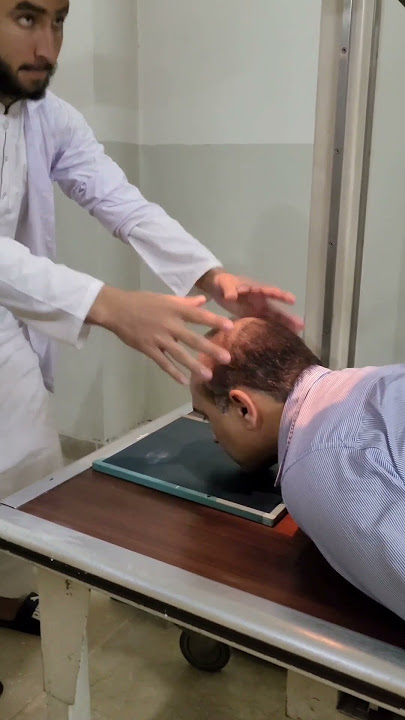 #X-Rays PNS_ PNS 45° degree_ #Examination facial sinuses water_#findings fracture_ plz subscribe