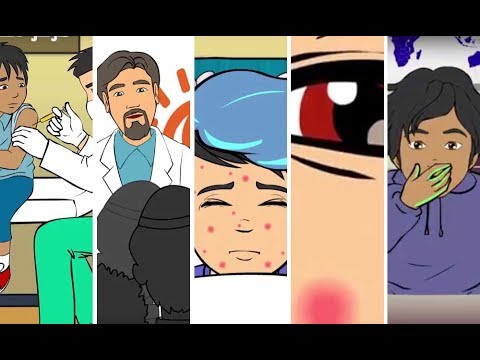 قصة مرض الحصبة