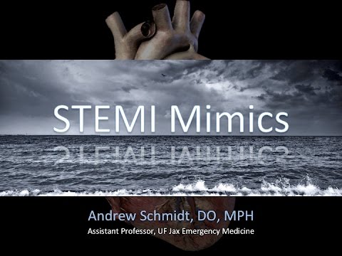 STEMI Mimics - JaxEMS