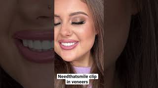 Needthatsmile clip in veneers snap on smile clip ins clip on veneers screenshot 2