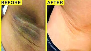 Underarms Whitening at home / Beauty parlour course screenshot 2