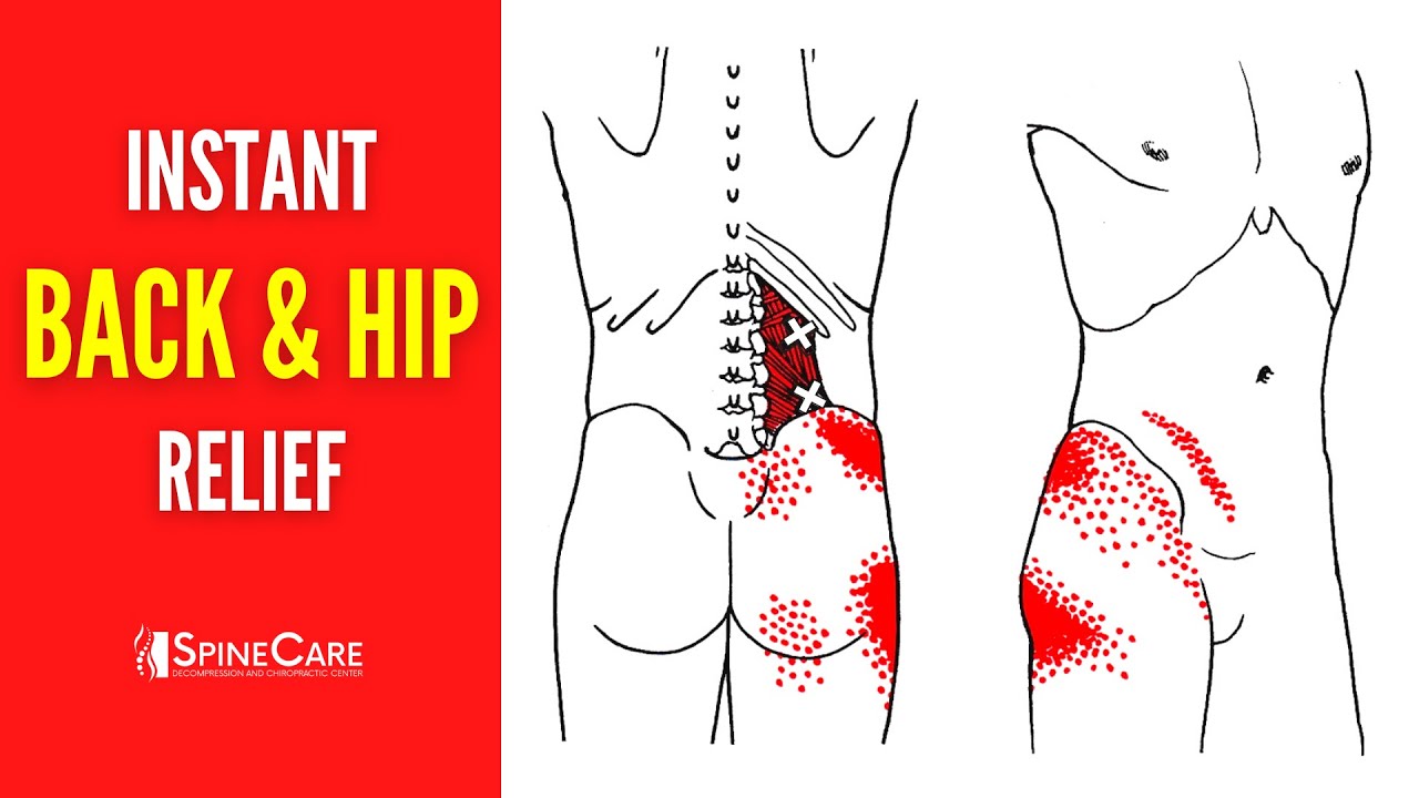 How to Tell the Difference Between Hip and Lower Back Pain