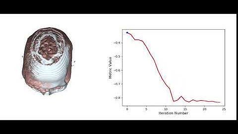 3d Medical Image Registration using SimpleITK