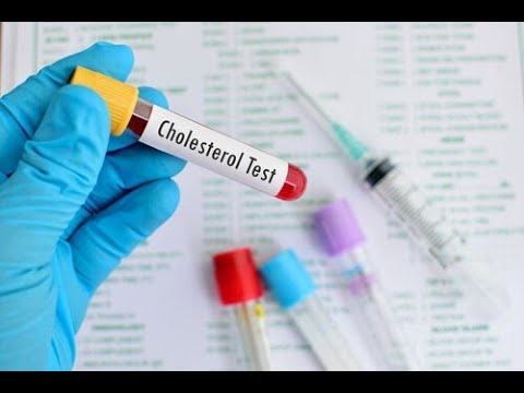 Video: Høy HDL-kolesterol: Kan Det Være Et Problem?