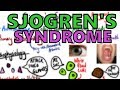 Sjögren's Syndrome - Explained in UNDER 5 Minutes!